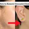 How-to-Remove-Unwanted-Hair