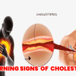 9 Warning Signs and Symptoms of High Cholesterol Should Never Ignore