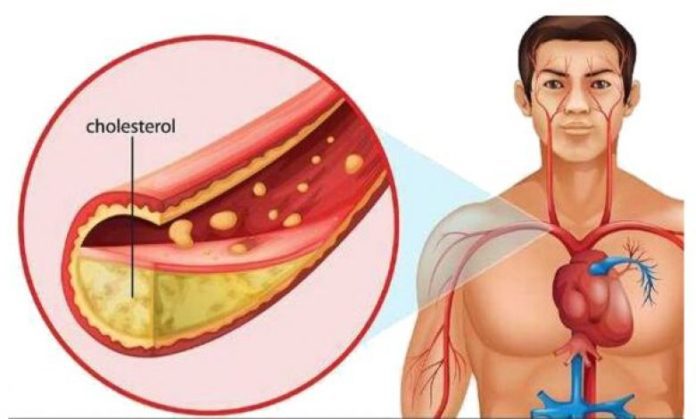 10 Foods Surprisingly Good for Lowering Cholesterol Quickly