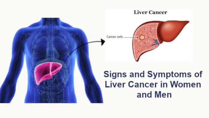 Signs-and-Symptoms-of-Liver-Cancer-in-Women-and-Men.jpeg