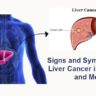 Signs-and-Symptoms-of-Liver-Cancer-in-Women-and-Men.jpeg