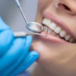 Girl with beautiful white teeth on reception at the doctor dentist.