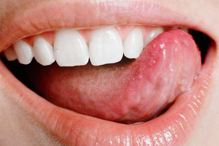 Canker Sores: Natural Home Remedies for Soothing Relief