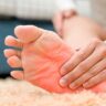 Cooling the Flames: Effective Home Remedies for Burning Feet Relief