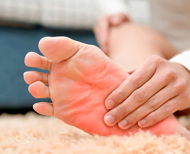 Cooling the Flames: Effective Home Remedies for Burning Feet Relief